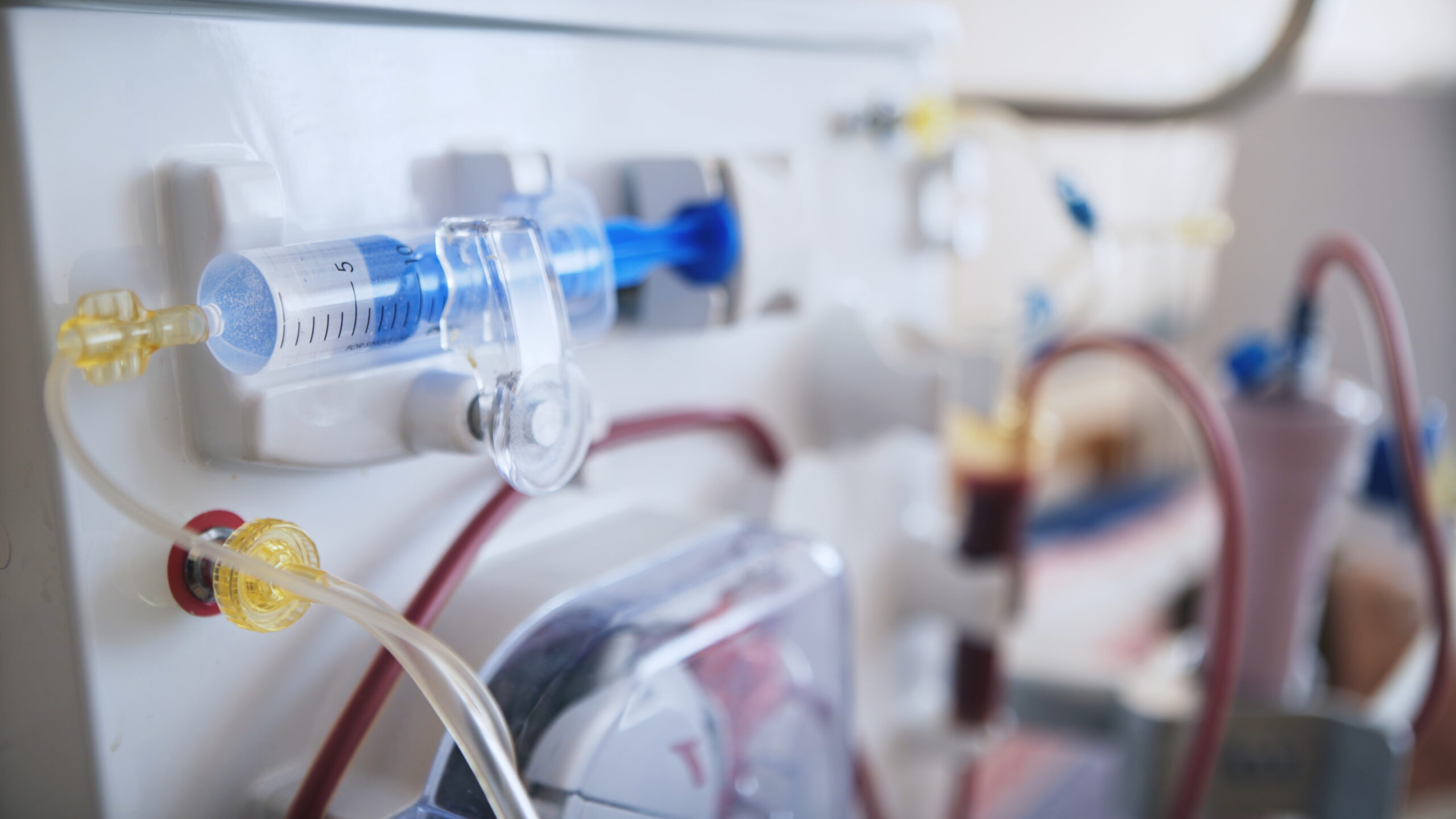 Aplicaciones de control de fluidos